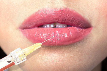 Naklejka premium Cosmetological Injection with a syringe for lip augmentation close-up macro