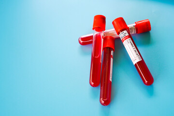 test tube with blood sample on blue background