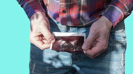 Ultrasound of a simple male in the hands of a patient is isolated on a blue background, a man looks...