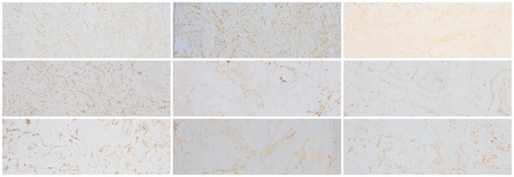 Collection of panoramic stone backgrounds. Dolomite texture set. Natural rock with beautiful beige patterns on the surface. Wide panoramas with polished flat stones. Decoration building material.