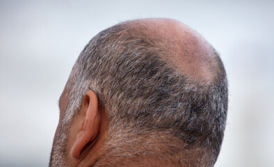 A receding hairline on the head of a gray-haired man.