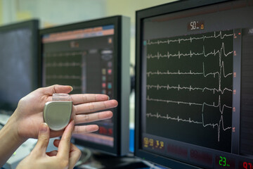 permanent pacemaker implantation device. This image demonstrates Permanent Pacemaker (PPM) on hands. - obrazy, fototapety, plakaty