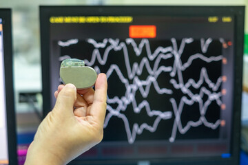 permanent pacemaker implantation device. This image demonstrates Permanent Pacemaker (PPM) on hands.
