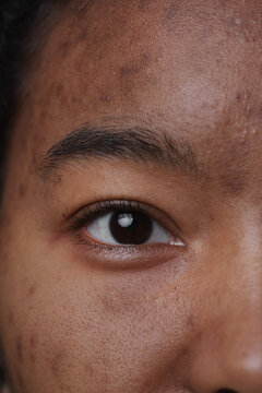 Extreme Close Up Of Real African American Woman Looking At Camera With Focus On Skin Imperfections