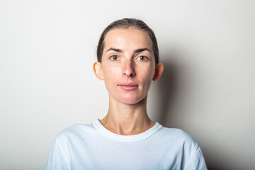 Young woman with protruding ears, on a light background. Auricle defect.