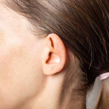 Lop-eared female ear, close-up on a light background. Auricle defect.