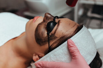 the girl at the cosmetologist's reception ,carbon peeling