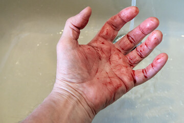 Male bloody hand in the bathroom sink