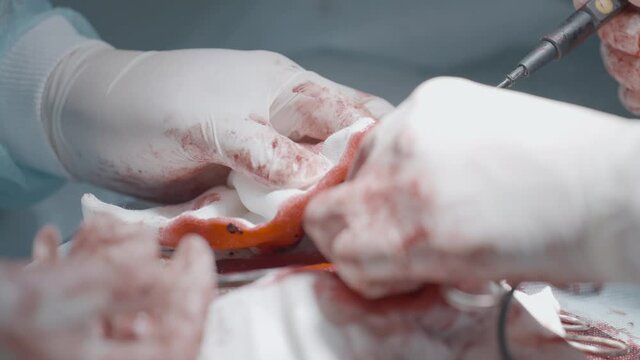 Operation on male organ. Action. Close-up of bloody operation on male sexual organ. Penis Enlargement Surgery