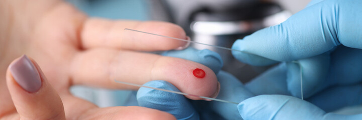 Doctor in protective gloves touching drop of blood on patients hand with specimen slide closeup....