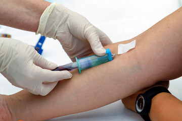 a doctor takes blood test from a patient for blood test close-up