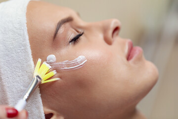 Close up woman's face with cream applied to cheekbones and cheeks after cosmetic procedures....