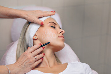 Young charming client drawing a grid with a white pencil for further acupuncture procedure....