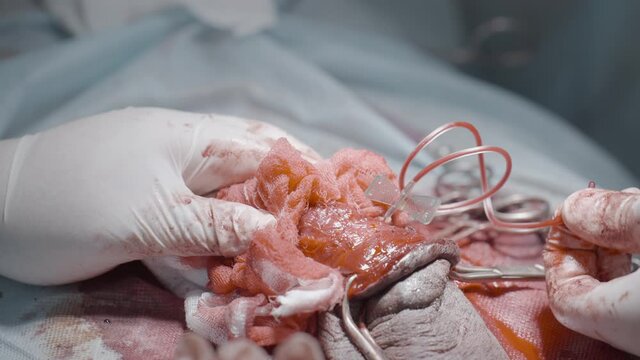 Blood tube in organ. Action. Close-up of surgeons carried out tube with liquid to body. Surgery on male sexual organ. Professional operation with flesh and blood