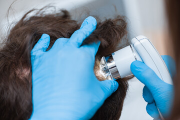 Diagnosis of diseases of the scalp by a trichologist