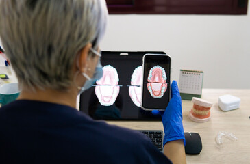 Dental technician looking at the mobile while designing a new dental prosthesis with his computer...