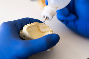 Hands of dental technician making new Prosthetics dental in laboratory.