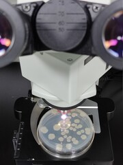 Microscopic observation of microbial culture results
