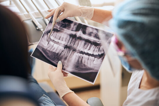 Close up of dentist holding X-ray picture
