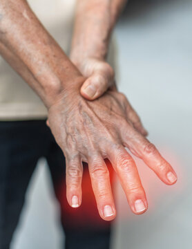 Peripheral Neuropathy pain in elderly patient on hand, palm, fingers and sensory nerves with numb, aching, muscle weakness, stabbing, burning from chronic inflammatory demyelinating polyneuropathy