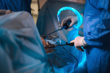 Endoscopic surgery to remove the uterus - 414682174
