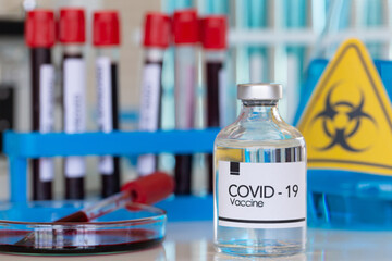 The Covid-19 vaccine lab equipment was placed on a table in a biological lab.