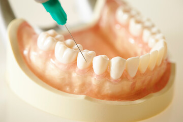 Denture prosthesis and syringe on white background