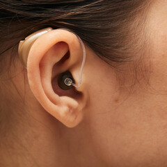 Hearing aid behind the ear woman, close-up, side view. Deafness treatment, hearing solution