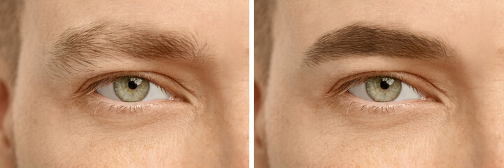 Fototapeta premium Collage with photos of man before and after eyebrow modeling, closeup. Banner design
