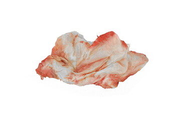Blood in tissue paper on a white background. Epistaxis (nosebleeds) treatment blood in tissue paper. 