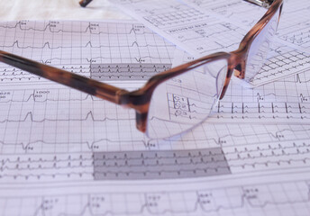 Eyeglasses on an EKG in the doctor's office. Representation of heartbeats on graph paper.
