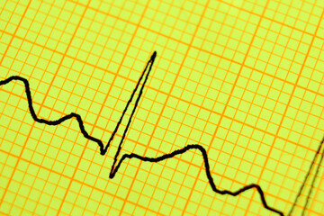 ekg line paper