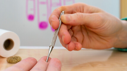 Su jok probe on man's hand. Korean traditional acupuncture therapy. Touching pain points with...