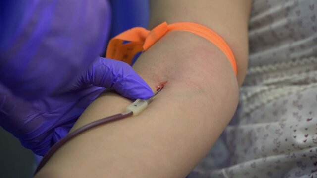 Front close-up, static shot of a woman with a tourniquet on her arm while donating blood and a nurse holding the catheter with blue gloves.