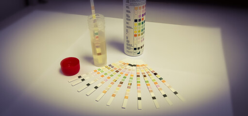 Reagent Strip for Urinalysis , Routine Urinalysis, check-up analysis in laboratory