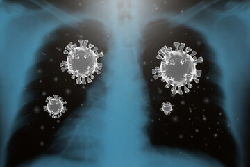 coronaviruses influenza COVID-19  X-ray film Used in medicine 3d rendering.