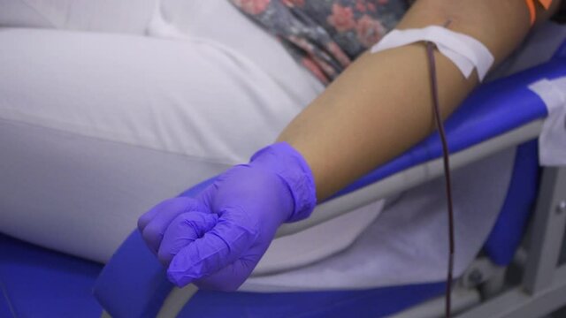 Side close-up, still shot of a woman arm while opening and closing her hand while donating blood with a catheter attached with medical tape.