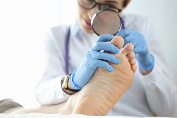 Dermatologist examining toenail with magnifying glass closeup