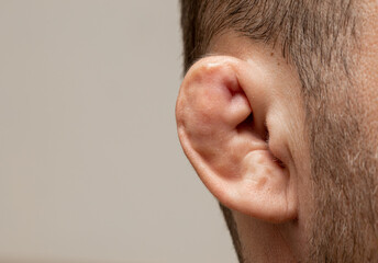 Photography of anatomy of the defective ear.