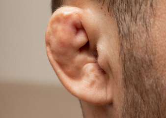 Broken ears close-up.