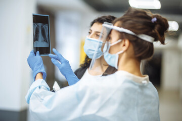 Fototapeta na wymiar Young doctor shows an X-ray photograph of lungs to the patient and explains the diagnosis. Coronavirus prevention and prophylaxy. Hospital and medicine concept.