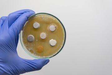 Close-up, a scientist holds an open Petri dish with agar columns in his hand, on which bacteria have grown. An experiment on antagonism of microorganisms.