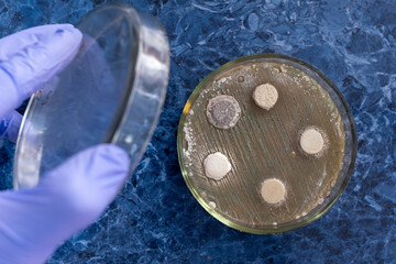 The scientist opened a Petri dish with bacteria colonies with his hand. The bacteria grew on agar posts. Cultivation of bacteria on agar.