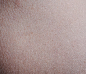 Texture of pink human skin