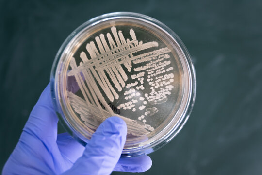 Close-up, the doctor holds in his hand a closed Petri dish with colonies of dangerous bacteria. The scientist obtained a pure culture of bacterial colonies.
