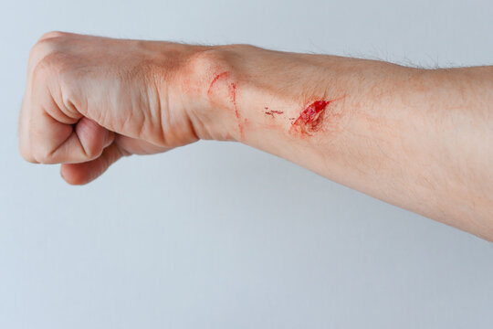 Close-up of a man's fist. The wounded hand of a man. Bleeding wound on the arm.