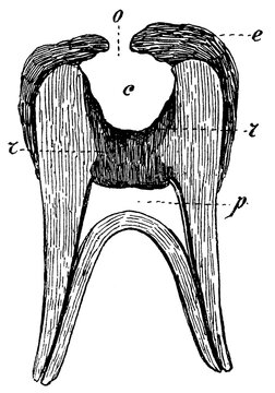 Tooth decay. Teeth becoming hollow. First stage. Illustration of the 19th century. Germany. White background.