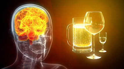 cg healthcare 3d illustration, brain affected by alcohol - obrazy, fototapety, plakaty