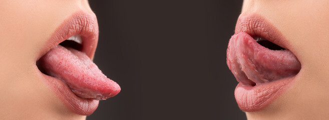 Obraz premium Lesbian girls love. Lgbt girl kiss. Romantic lips. Sexy female lip.