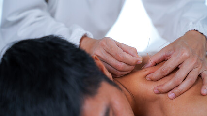Fototapeta na wymiar The doctor treats with acupuncture. Traditional Chinese Medicine